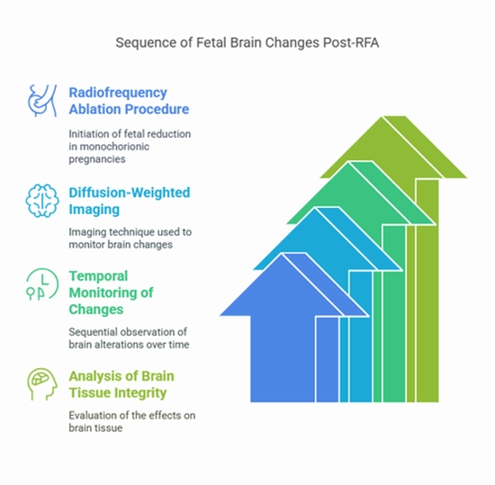 foetal reduction in monochorionic pregnancies {faces}